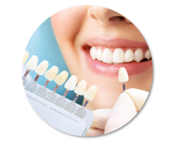Carilla dentales la solución estética para tu sonrisa