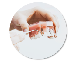 4-Precio-implantes-dentales-DentiSalud