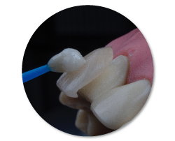 Protesis implantes dentales de la mejor calidad con DentiSalud